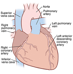 Front view of heart, great vessels, and coronary arteries.