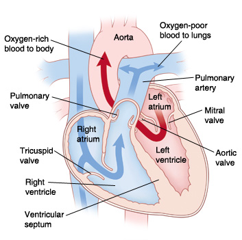 Four-chamber view of heart showing double outlet right ventricle. Arrows indicate blood flowing from right ventricle to pulmonary artery and aorta.