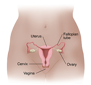 Front view of female pelvis showing cross section of uterus, ovaries, and fallopian tubes.