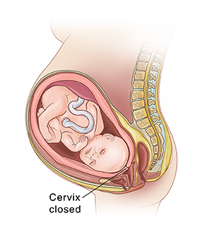 Side view of fetus in uterus showing cervix thick and closed.