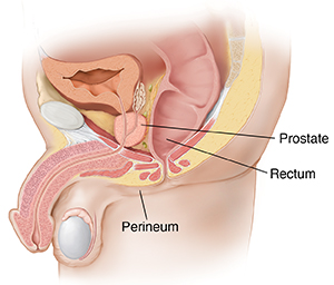 Side view cross section of male pelvis showing the prostate and rectum.