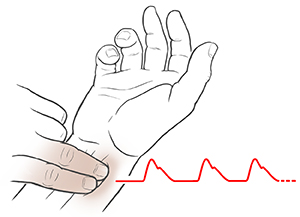 Hand palm side up showing two fingers from opposite hand pressing two fingers below thumb. ECG trace shows heartbeat.