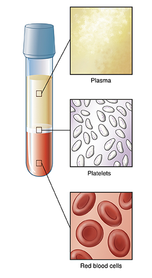 Vial of blood separated into parts, with closeups of plasma, platelets, and red blood cells.