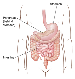 Outline of child's abdomen showing stomach, pancreas, and intestine.