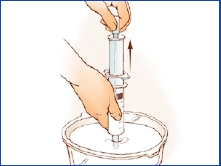 Imagen de una sonda de alimentación